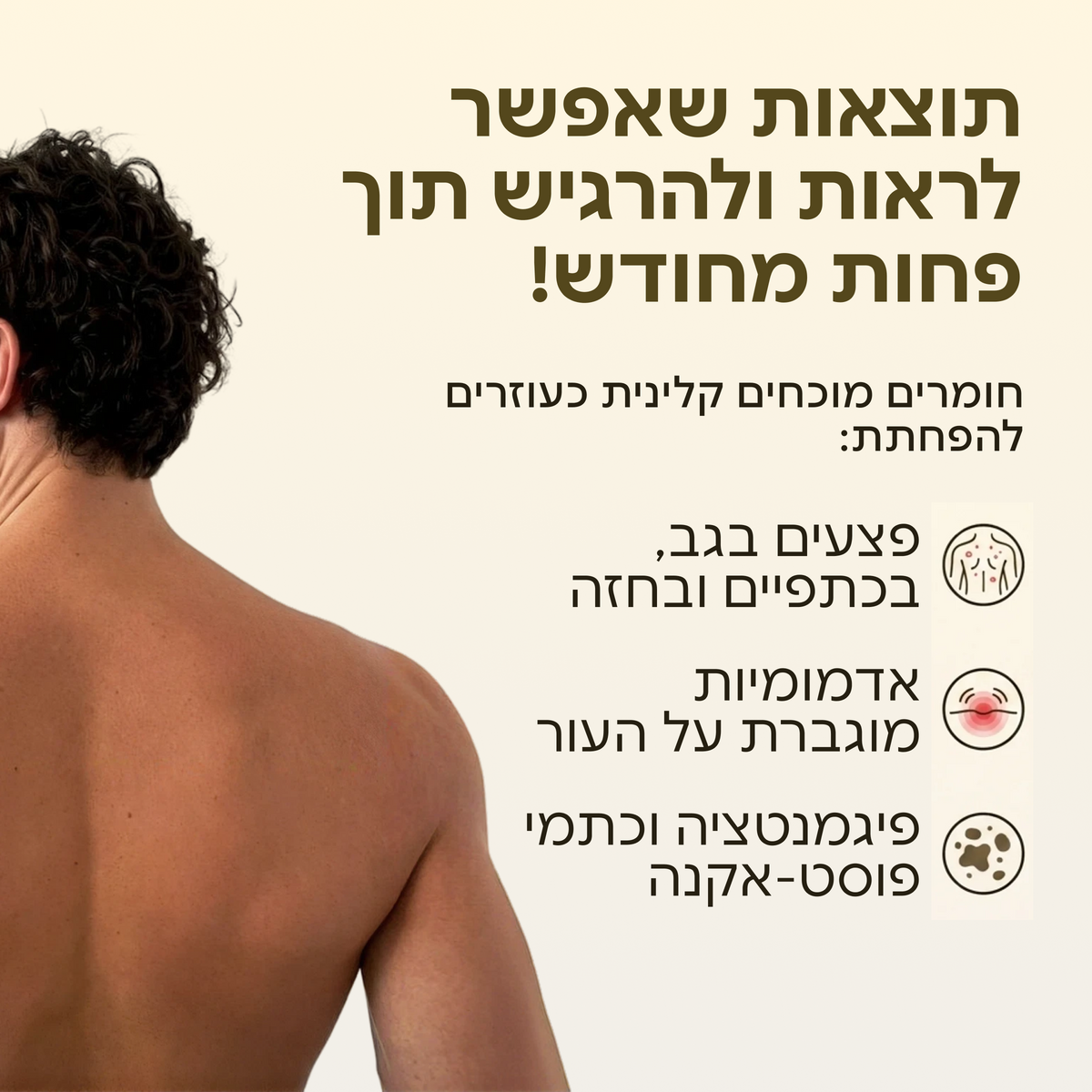 Dermalabs ActiveClear - טיפול באקנה גוף תוך 30 יום
